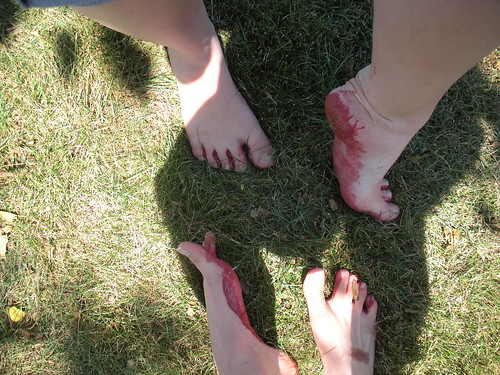 Bloody feet with shattered glass.