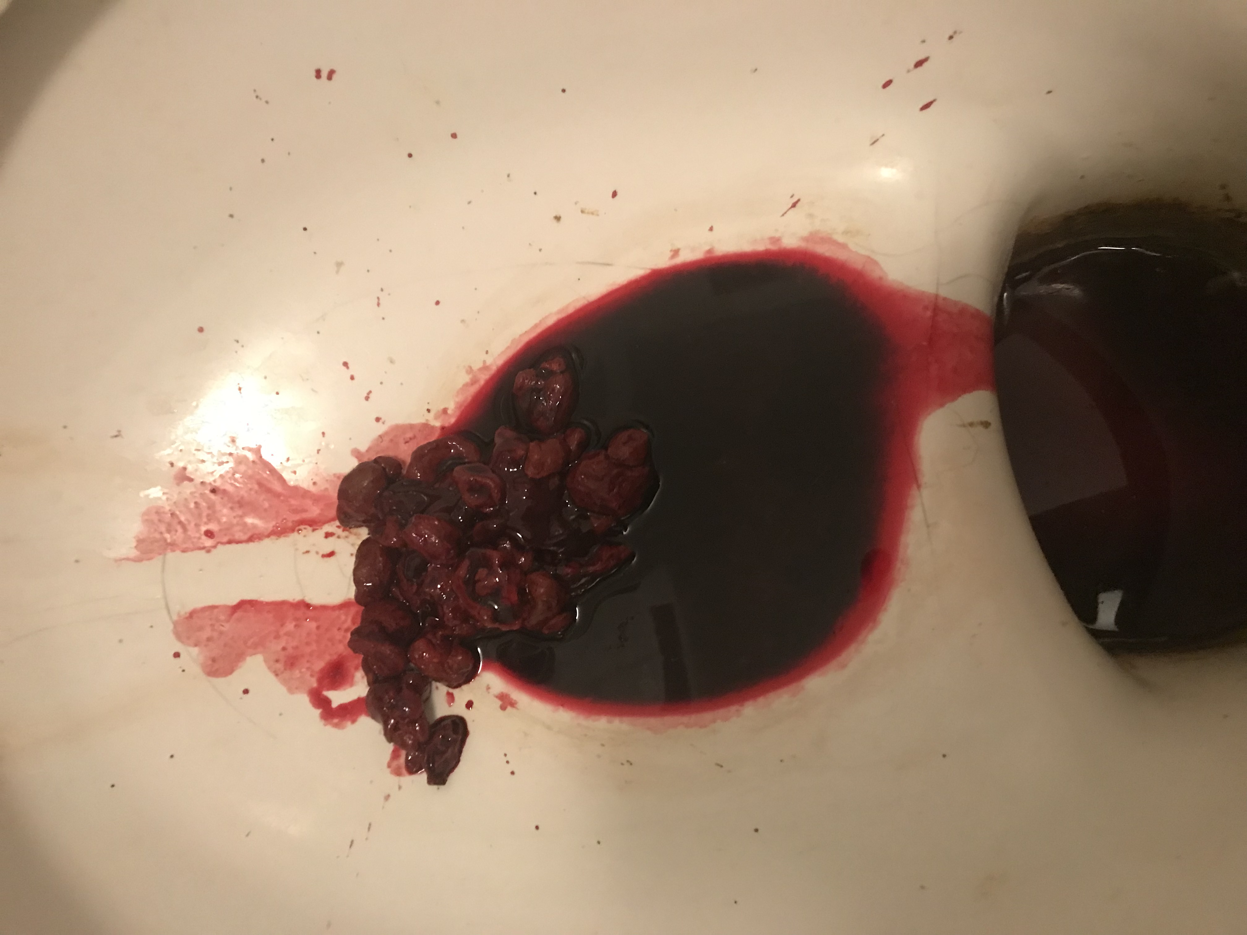 Bloody urine in a toilet bowl.