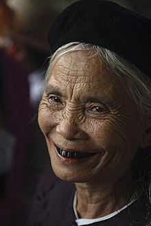 Divorced woman with blackened teeth