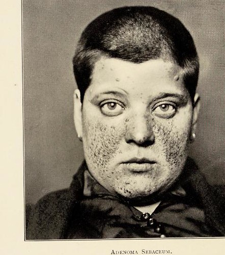 Image of a person with a skin disease.