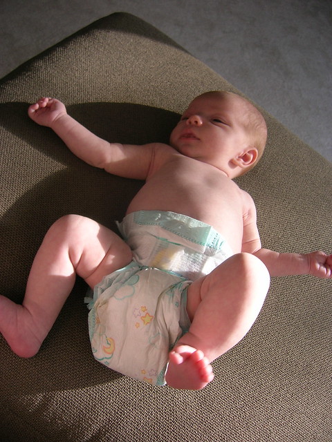 Massive infant in a diaper